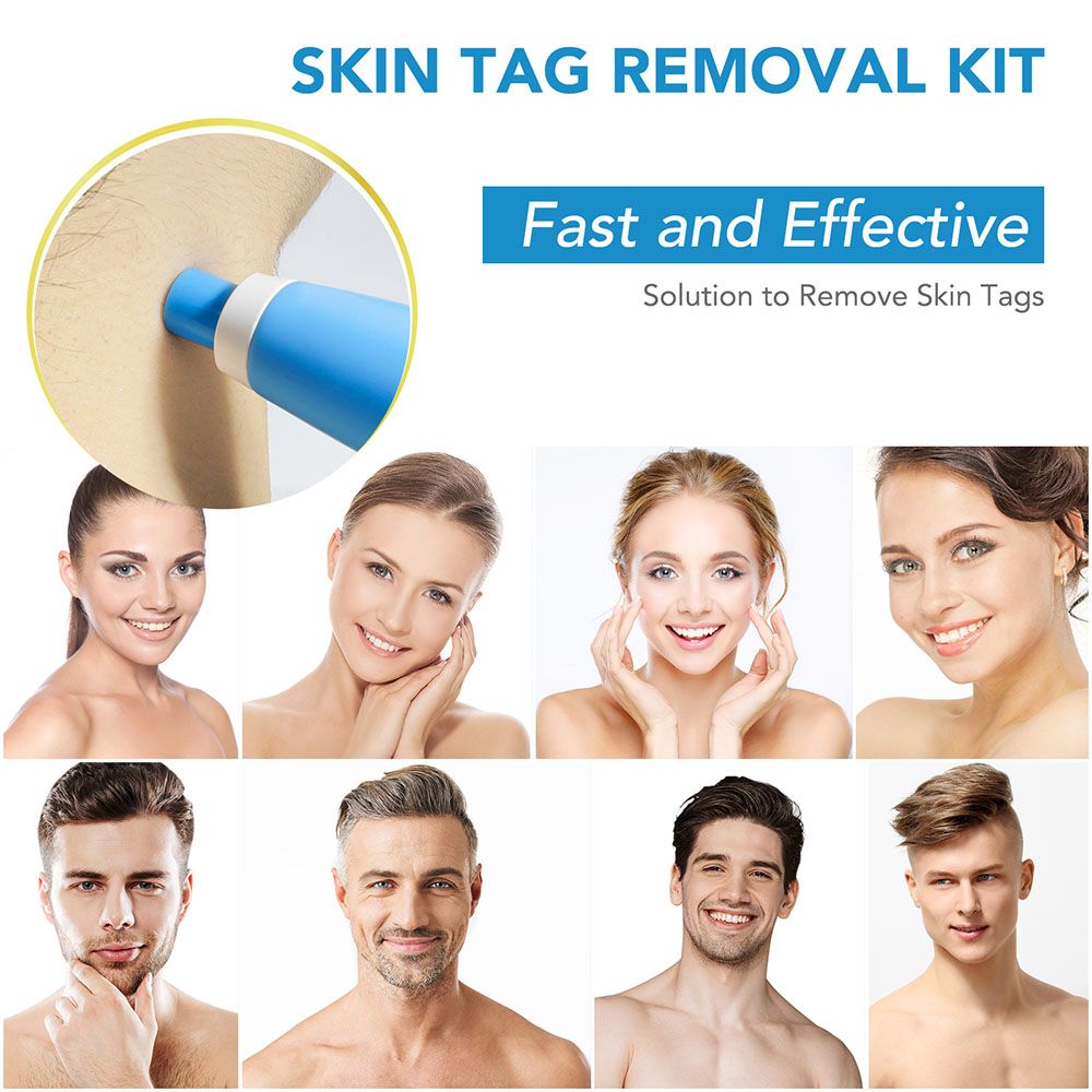 SEFUDUN Alat Penghilang Kutil Auto Skin Tag Mole Removal Kit - LGV41