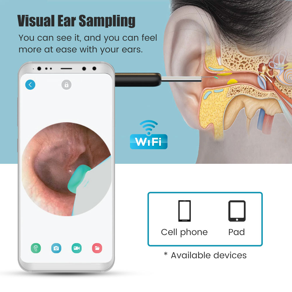 NATFIRE Kamera Pembersih Telinga Korek Kuping Endoscope HD WiFi - NE16