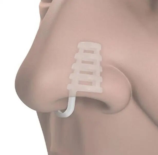 Alat Bantu Anti Ngorok Mendengkur Nose Breathing Stop Snoring 4 PCS