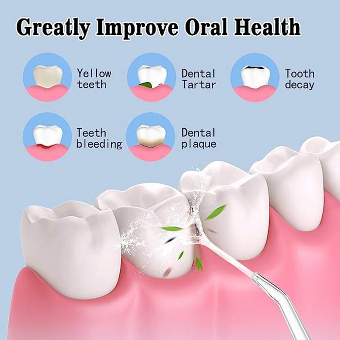 DentalSpa Semprotan Pembersih Gigi Oral Irrigator Smart Tooth Flusher - A10